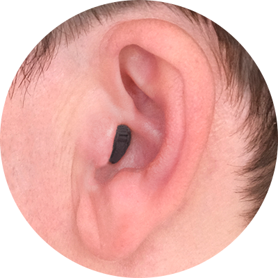 Completely-in-Canal (CIC)